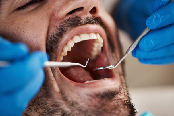 Best Root Canal Treatment  in Osceola, IN