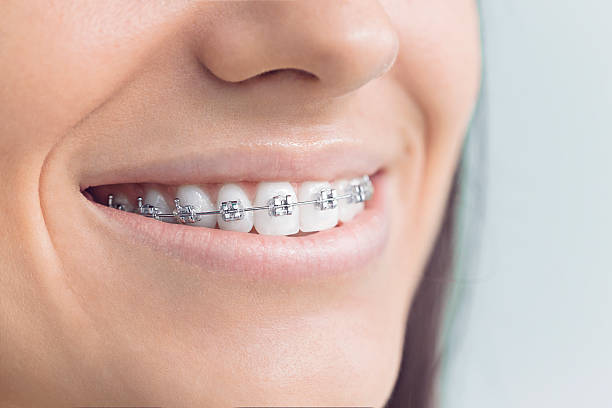 Best Invisalign and Clear Aligners  in Osceola, IN